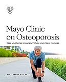 Mayo Clinic on Osteoporosis: Keep your bones strong and reduce your risk of fractures