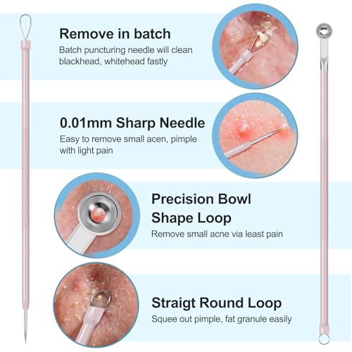 UWOIST Pimple Popper Tool Kit Blackhead Remover Tools (5 Piece Kit), Professional Stainless Black Head Remover for face, Risk Free Treatment Pimple Extractor with Tweezers