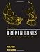 Broken Bones: Anthropological Analysis of Blunt Force Trauma