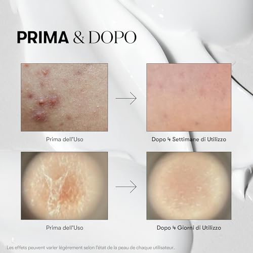 Vt Cosmetics Vt Mild Reedle Shot 50 - Essenza Riparatrice Giorno E Notte Per Pelle Opaca E Stanca, 50 Ml - 5