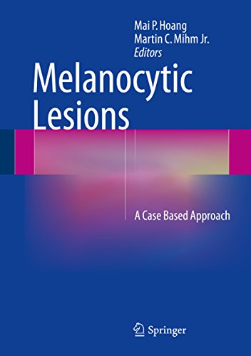 Melanocytic Lesions: A Case Based Approach