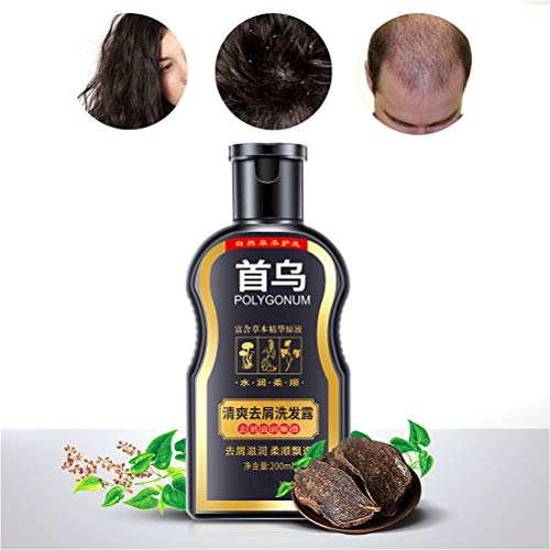 Polygonum Multiflorum Shampoo Anti-Dandruff Shampoo Moisturizing Oil Control Shampoo Hair Care Shampoo