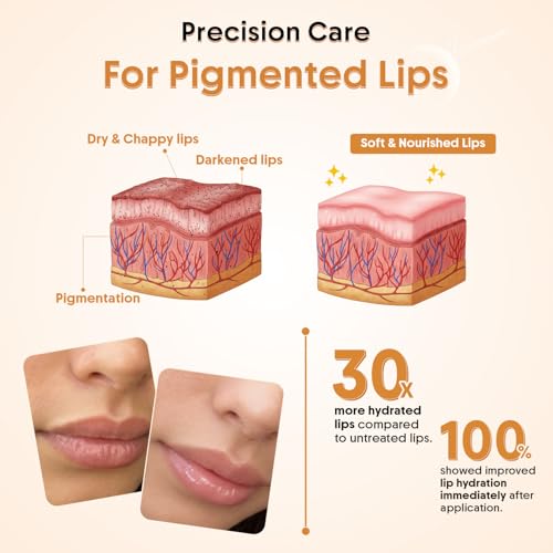 Image of Aravi Organic Barrier Repair Natural Lip Balm SPF 50 PA++++ | Lip Balm for Dark, Dry & Pigmented Lips | Kojic Acid, Ceramide & Peptide | Brightening, Hydrating & Sun Protection Lip Balm for Women & Men - 5g