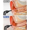 Electric Ear Wax Removal, Ear Cleaning Kit with Water Powered Ear Cleaner, Featuring 3 Pressure Settings and 12 Replacement Tips, Effective Ear Cleaning Tool