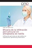 rodillas articulaciones ardor  Eficacia de la infiltración peri-articular en artroplastia de rodilla: Infiltración peri-articular de rodilla con ropivacaina, epinefrina y ketorolaco