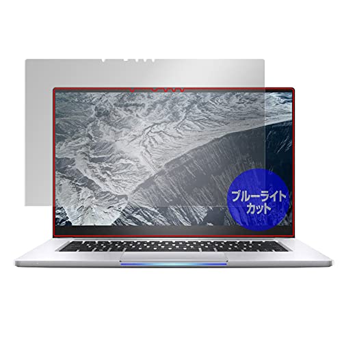 ~rbNX Ce NUC M15 m[gubN PC Lbg p u[CgJbg ڂɗD ی tB { OverLay Eye Protector