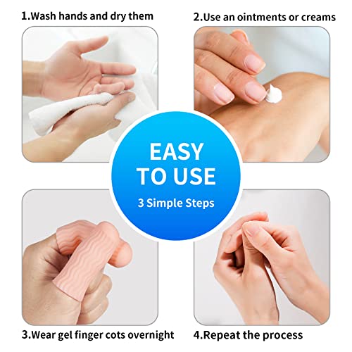 tifanso-12-PCS-Finger-Cots-Finger-Protectors-Gel-Finger-Gloves-Covers-Fingertip-Sleeves-Guards-for-Cracked-Skin-Trigger-Finger-and-More-Large-Size