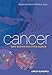 Cancer: Basic Science and Clinical Aspects -  Almeida, Craig A., Paperback