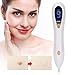 Produktbild Laser Pen Dot Mole Removal Picosecond Pen, laser tattoo entfernung Skin Tag Removal Pen 9 Zahnräder Freckle Pen, Lichttherapie Tattoo Narbe Mole Sommersprossen Entfernung Dark Spot Remover Maschine