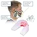 PerGar Tooth Guard, Double Sided Adult Mouth Guard, Shock Absorbing Tooth Guard, Boxing Taekwondo CombatAccessory, Comes with Storage Box