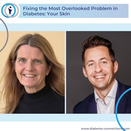 Fixing the Most Overlooked Problem in Diabetes: Your Skin