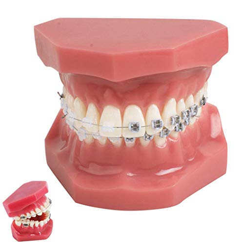 Model ortodontyczny zębów dentystycznych z metalowymi i ceramicznymi wspornikami modele demonstracyjne dla dentysty do komunikacji z pacjentami