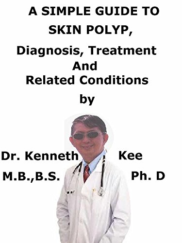 A Simple Guide To Skin Polyp, Diagnosis, Treatment And Related Conditions (A Simple Guide to Medical Conditions) (English Edition)