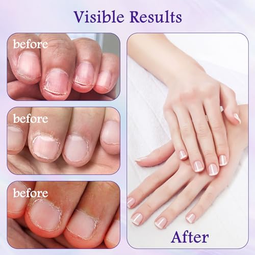 3-In-1 Nagelpflegestift, 2026 Neu Nagelöl Stift Cuticle Oil Pen, Moisturizing and Brightening Nagelpflegestift, Pflege Zur Reparatur Trockener Beschädigter Nägel (1PC)