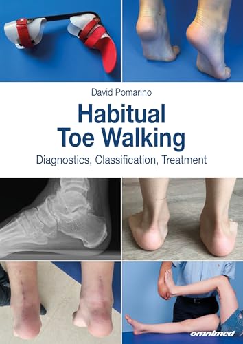 Habitual Toe Walking: Diagnostics, Classification, Treatment