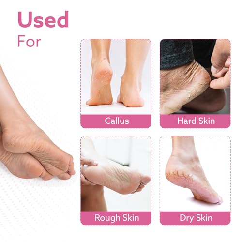 Image of AGARO Callus Remover Replaceable Heads, 2 Pcs, Callus & Dead Skin Removal Filer, Pedicure at Home