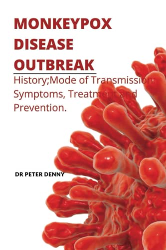MONKEYPOX DISEASE OUTBREAK: History;Mode of Transmission; Symptoms, Treatment and Prevention.