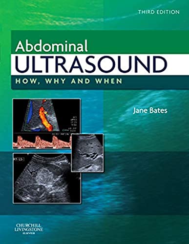 Abdominal Ultrasound: How, Why and When