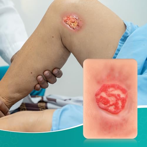Image of Pressure Ulcer Wound Model Stage 3 Pocket Size