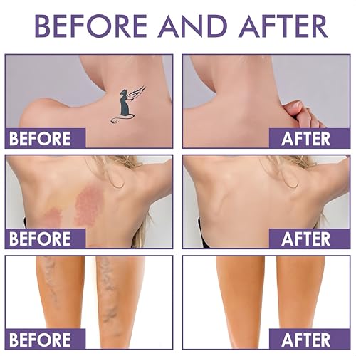 image for JYOVQXF Waterproof Body Concealer For Legs And Body,Tattoo And Scar Co