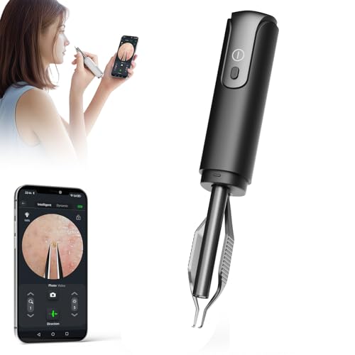 Blackhead Removal Tweezer with 1080p Camera Ultimate Precision: Blackhead Removal with Camera - Perfect for Delicate Tasks! - - Ingrown Hair Ear Hair Tweezer (Black)