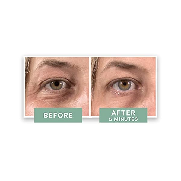 Park-Perfection-Instant-Eye-Lift-Eye-Cream-to-Visibly-Reduce-Fines-Lines-Crows-Feet-Puffiness-and-Dark-Circles-Instantly-and-Over-Time-05-FL-OZ Park Perfection Instant Eye Lift - Eye Cream to Visibly Reduce Fines Lines, Crow's Feet, Puffiness, and Dark Circles Instantly and Over Time (0.5 FL. OZ.).