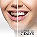 Teeth Whitening Kit - Teeth Whitening Kit with Led Light and 3 Teeth Whitening Gel Pens - Whitening Kit for Men and Women, 5 Piece Set