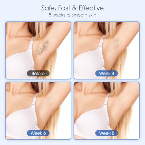 IPL Laser Geräte Haarentfernung, 0,5 Sek./Blitz Schmerzfreie Eis-Haarentfernung mit Zwei Präzisen Köpfen für Gesicht und Bikini, Geeignet für Gesicht, Achseln, Beine, Bikini Laser Haarentfernung