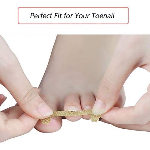 EBANKU Ingrown Toenail Kit, 5 Sheets Ingrown Toenail Corrector Patch Breathable Self-Adhesive Ingrown Toenail Treatment Elastic Patch Fingernail Care Protects Toe Nail Stickers 20PCS - Image 3