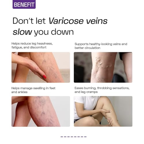 Image of Varco Leg Care Topical Phyto Oil For Management Of Varicose Veins, Spider Veins| Deep Penetration Formula Helps reach the root cause of varicose veins| Reduces Cramps, Painful Legs & Swelling- 60ml