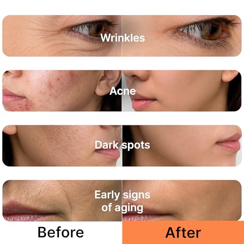 Image of Dual Retinol & Peptide Night Cream 100g | Smart Retinol -Peptide Complex with Matrixyl, Argireline, Copper & Niacinamide Capsule Cream | Korean Boba Cream Wrinkle Repair, Firming & Brightening Moisturiser