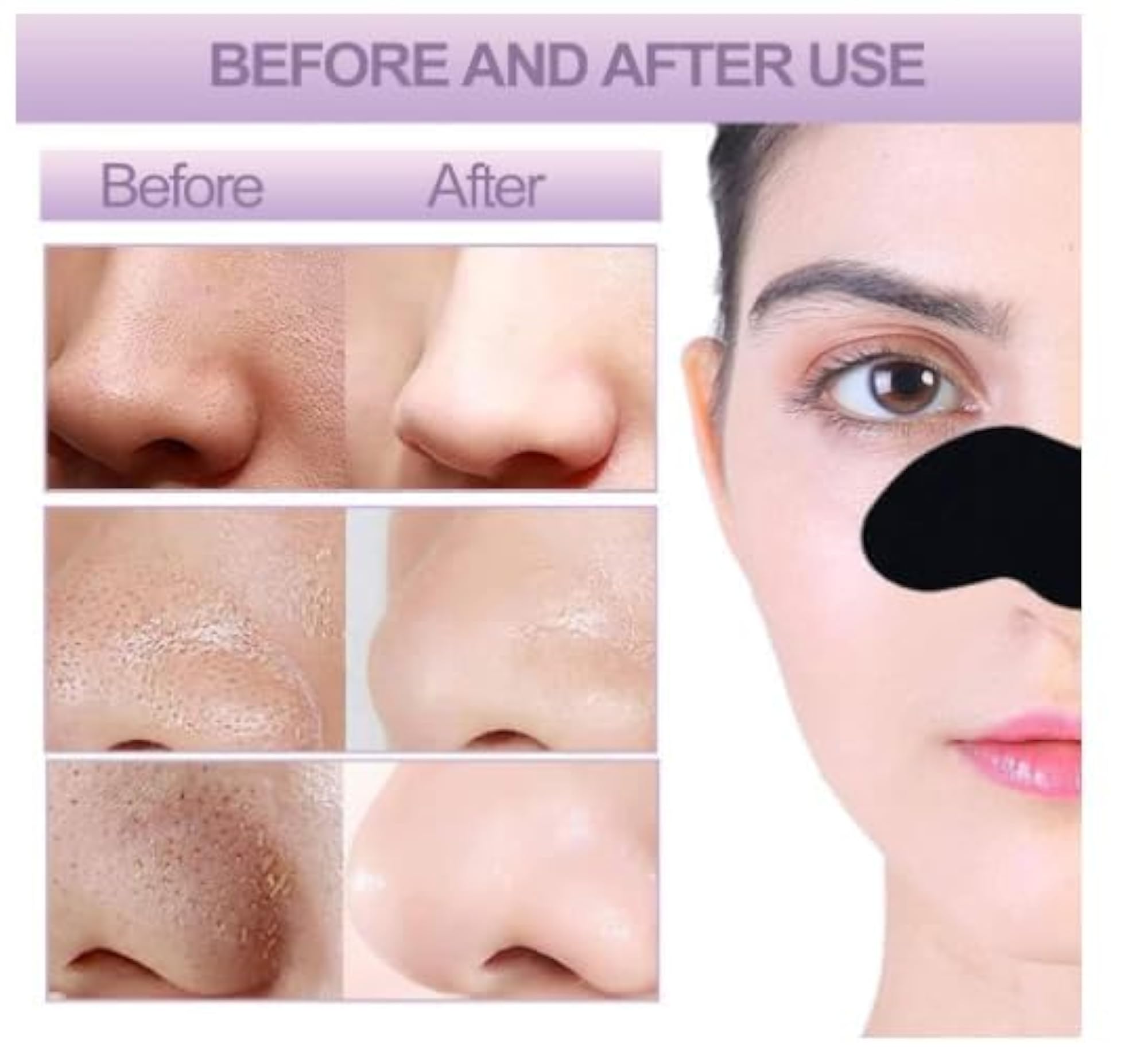 Charcoal Pore Strips for Blackhead Removal, Pack of 6