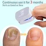 Nail Fungus Light Therapy Device With Time Display, Nail Cleaning Device for Damaged Discolored Thick Toenails & Fingernails, Rechargeable Toenail Fungus Remover (One Size A) - Image 5
