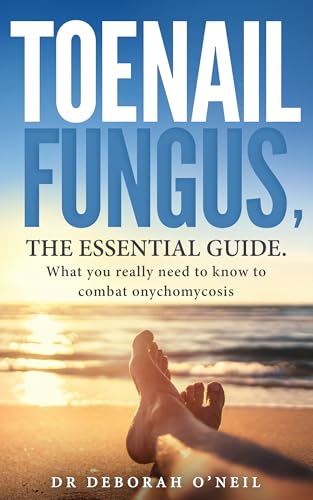 Toenail Fungus, The Essential Guide: What You Really Need to Know to Combat Onychomycosis (English Edition)