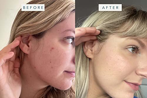 Brandefy Superfood Face Wash - Kale, Green Tea, Spinach, Vitamin C, E, K2. Brightening, Vegan Face Wash For All Skin Types, 8 Fl. Oz. Made In The Usa #TOP1