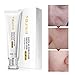 Produktbild Mimiga Whitening Cream Whitening Serum Hautcreme Whitening Creme zum entfernen von Sommersprossen braunen Flecken Anti Blemish