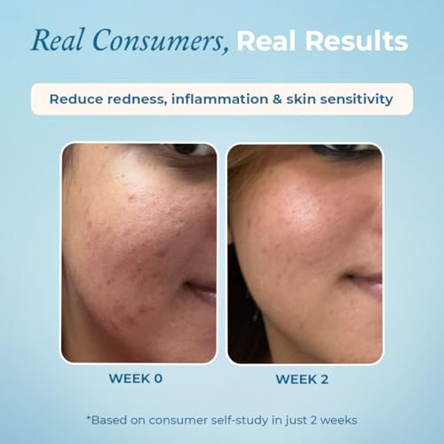 Image of The Pink Foundry Gentle Hydrating Creamy Face Wash for all Skin Types | Boost Hydration, Strengthen Skin Barrier & Reduces Dryness | Soap free, Fragrance Free & Sulphate Free | Vegan Face Wash | For Men & Women | 125ml