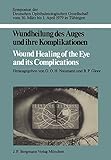  Wundheilung des Auges und ihre Komplikationen / Wound Healing of the Eye and its Complications: Symposion der Deutschen Ophthalmologischen ... Deutschen Ophthalmologischen Gesellschaft)