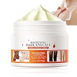 Body Cream with Vitamin C – Lighten Dark Knuckle & Evens Skin Tone. Moisturizing Cream for All Skin Types, Including Black Skin. Achieve Radiant