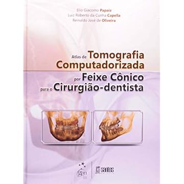 Capa do livro Atlas de Tomografia Computadorizada por Feixe Cônico para o Cirurgião-Dentista