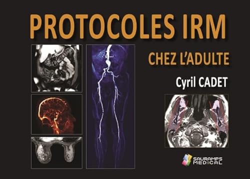livre PROTOCOLES IRM CHEZ L ADULTE