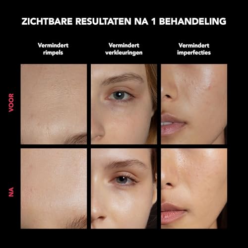 Foreo Faq 202 LED-lichtmasker met HA patches - View 3