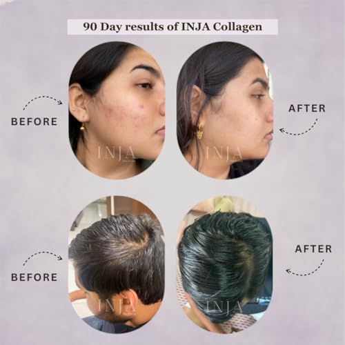 Image of INJA Fit Hydrolyzed Marine Collagen Supplement Powder for Women & Men, Japanese formulation Collagen with Vitamin C, Healthy Joints, Muscles, Skin, Hair, Sugar-Free, Gluten-Free, Chocolate Flavor, 250 gm