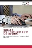  Diseño e implementación de un Exoesqueleto: Para rehabilitación del síndrome del túnel carpiano