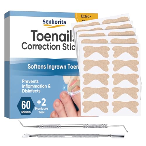 Senhorita Ingrown Toenail Treatment, 60Pcs No Glue Ingrown Toenail Corrector Patches, Ingrown Toenail Removal Kit with File and Lifter, Professional Painless Pedicure for Toenail