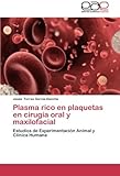 plasma rico en plaquetas para que sirve  Plasma Rico En Plaquetas En Cirugia Oral y Maxilofacial