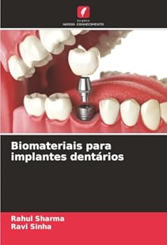 Paperback Biomateriais para implantes dentários [Portuguese] Book
