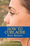 How To Cure Acne: What Is Acne And The Best Treatments For Acne
