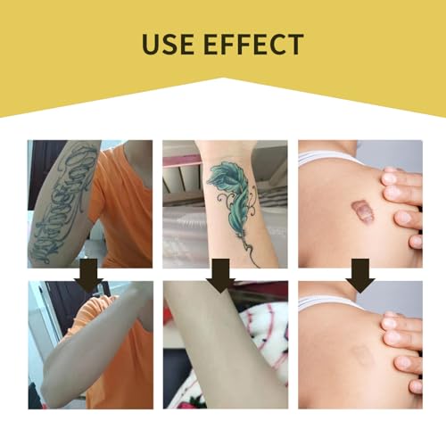 LXIANGN Waterproof & Sweatproof Ultra Thin Tattoo Cover Up Tape - Breathable, Natural Skin Concealer Sticker Patch for Covering up Tattoos, Scars, Dark Spots & Birthmarks