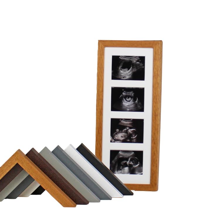Baby Scan Photo Frame, Multi-Aperture Frame for Four Ultrasound Photos. Baby Shower | Pregnancy Announcement | Nursery Display (Dark Grey)